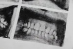ER Teeth Grid White T-Shirt - Image 5